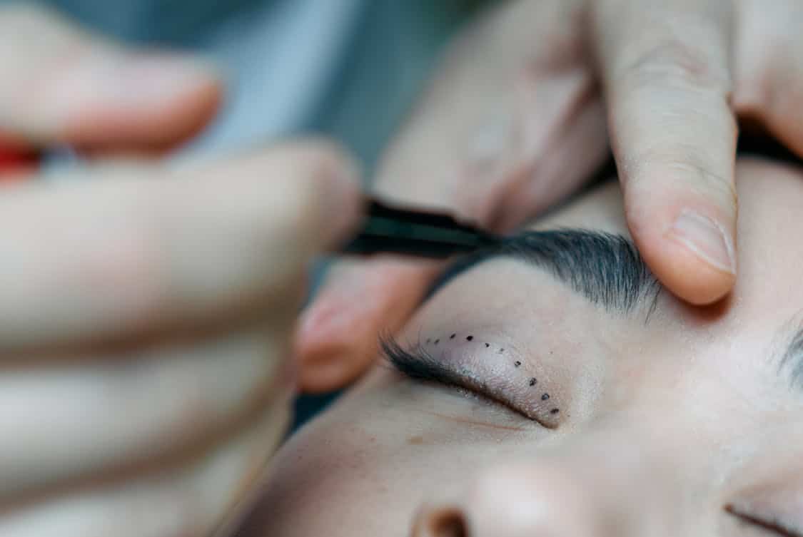 A Step-by-Step Guide to Preparing for Plastic Surgery