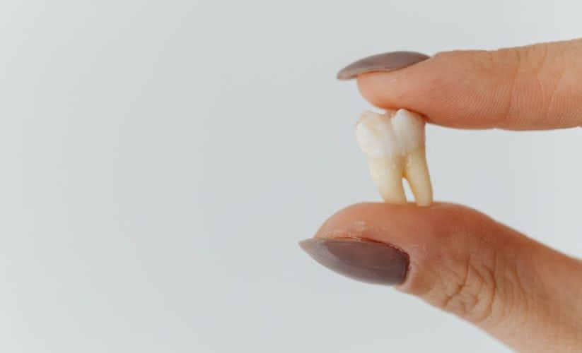 Why Ignoring Missing Teeth Can Cost You More Later